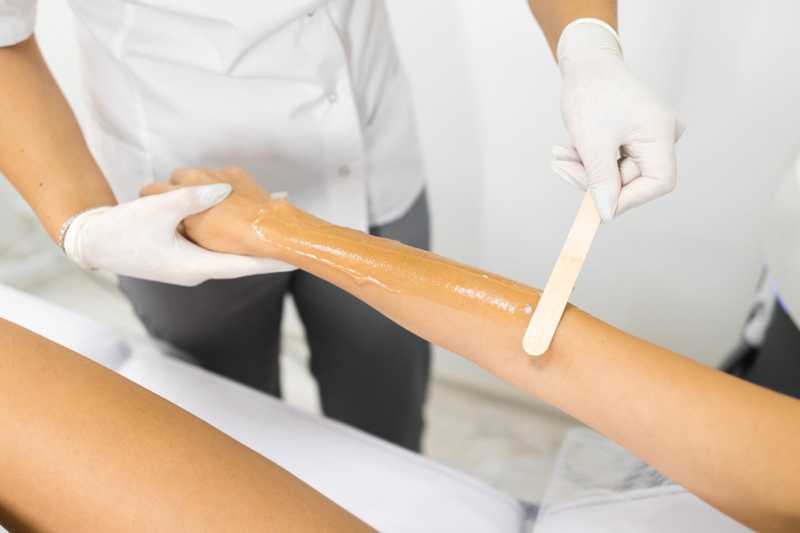 Applying a cooling gel to the hand before the laser hair removal procedure