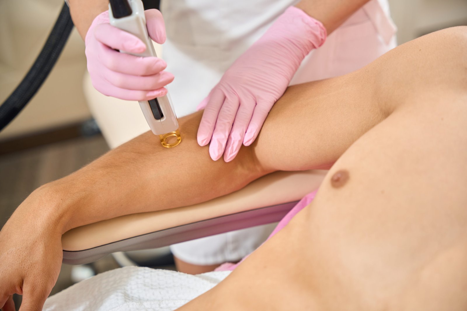 Man at a laser hair removal session for his arms, a cosmetologist using modern equipment